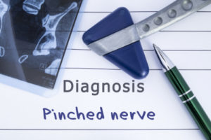 pinched nerve